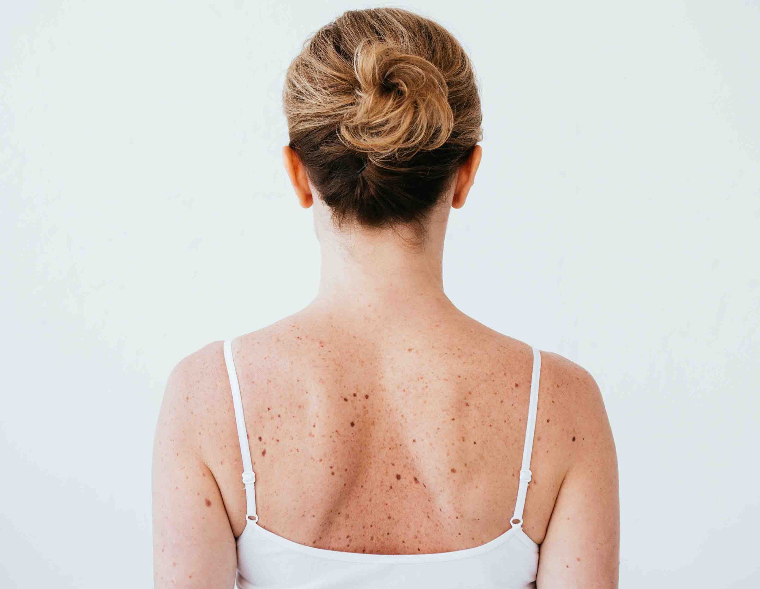 Donna vista di spalle, simbolo di ciclo mestruale irregolare tipico dell&rsquo;oligomenorrea