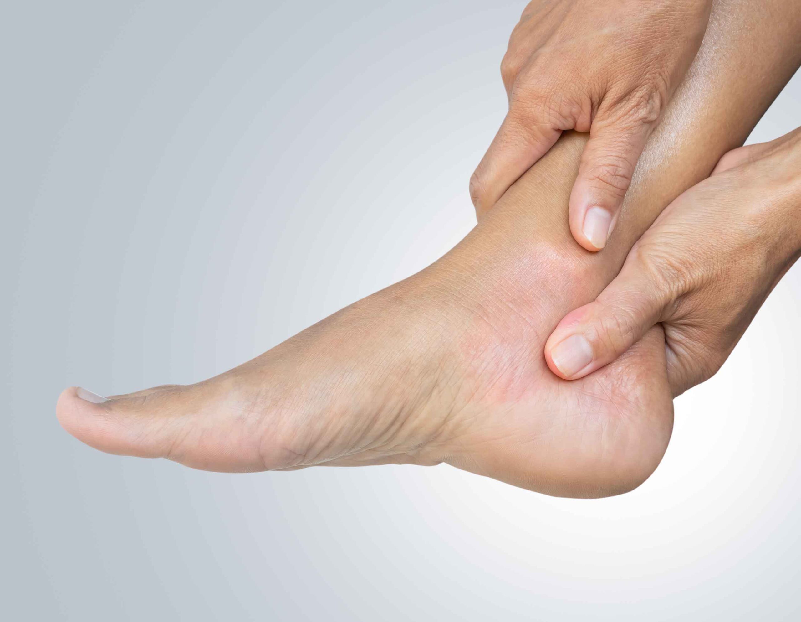 Dolore al tallone e pianta del piede causato da spina calcaneare, persona che massaggia il piede
